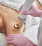 גד מדיקל: הדרך הנעימה ביותר להסרת שיער בלייזר-תמונה